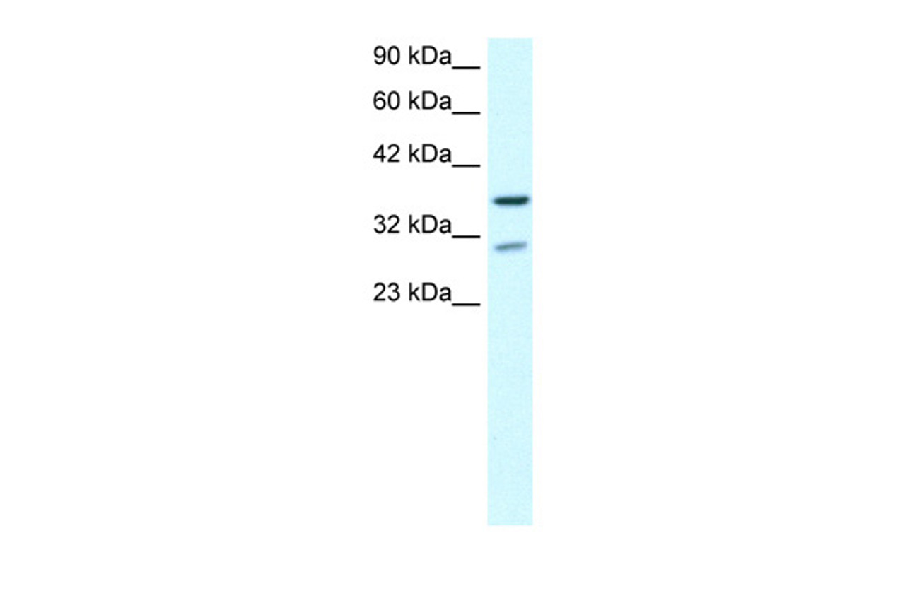 Antibody used in WB on Human brain at 0.2-1 ug/ml.