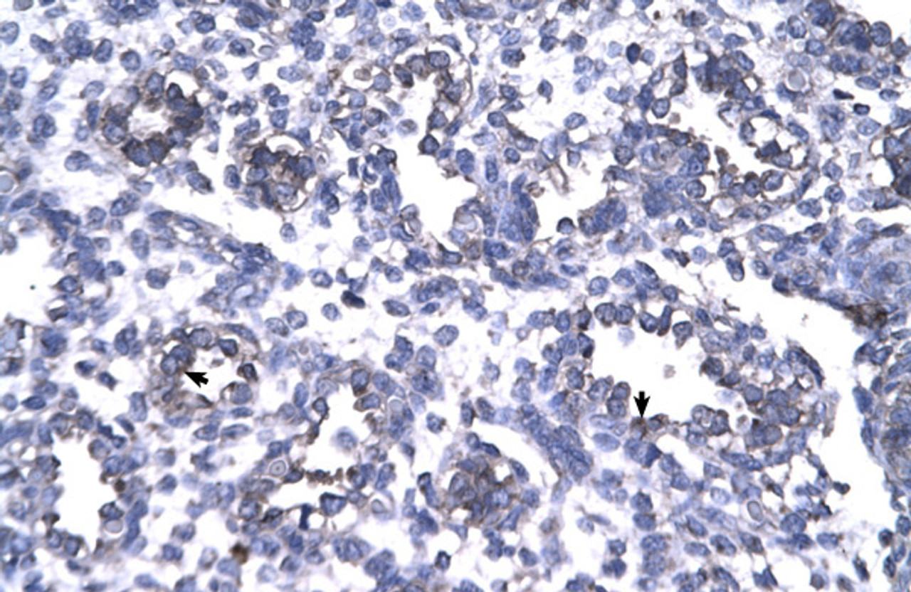 Antibody used in IHC on Human Lung.