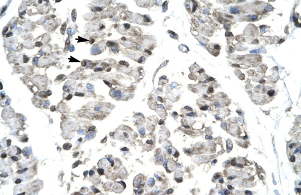 Antibody used in IHC on Human Skeletal Muscle.