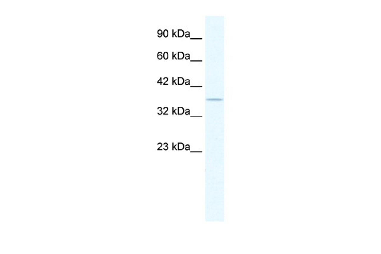 Antibody used in WB on Human Jurkat 1.25 ug/ml.