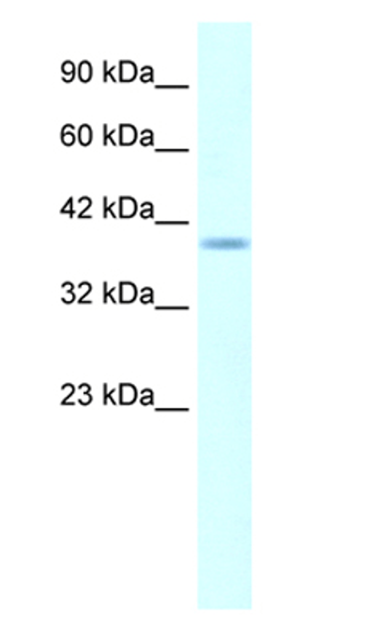 Antibody used in WB on Human Daudi at 5.0 ug/ml.