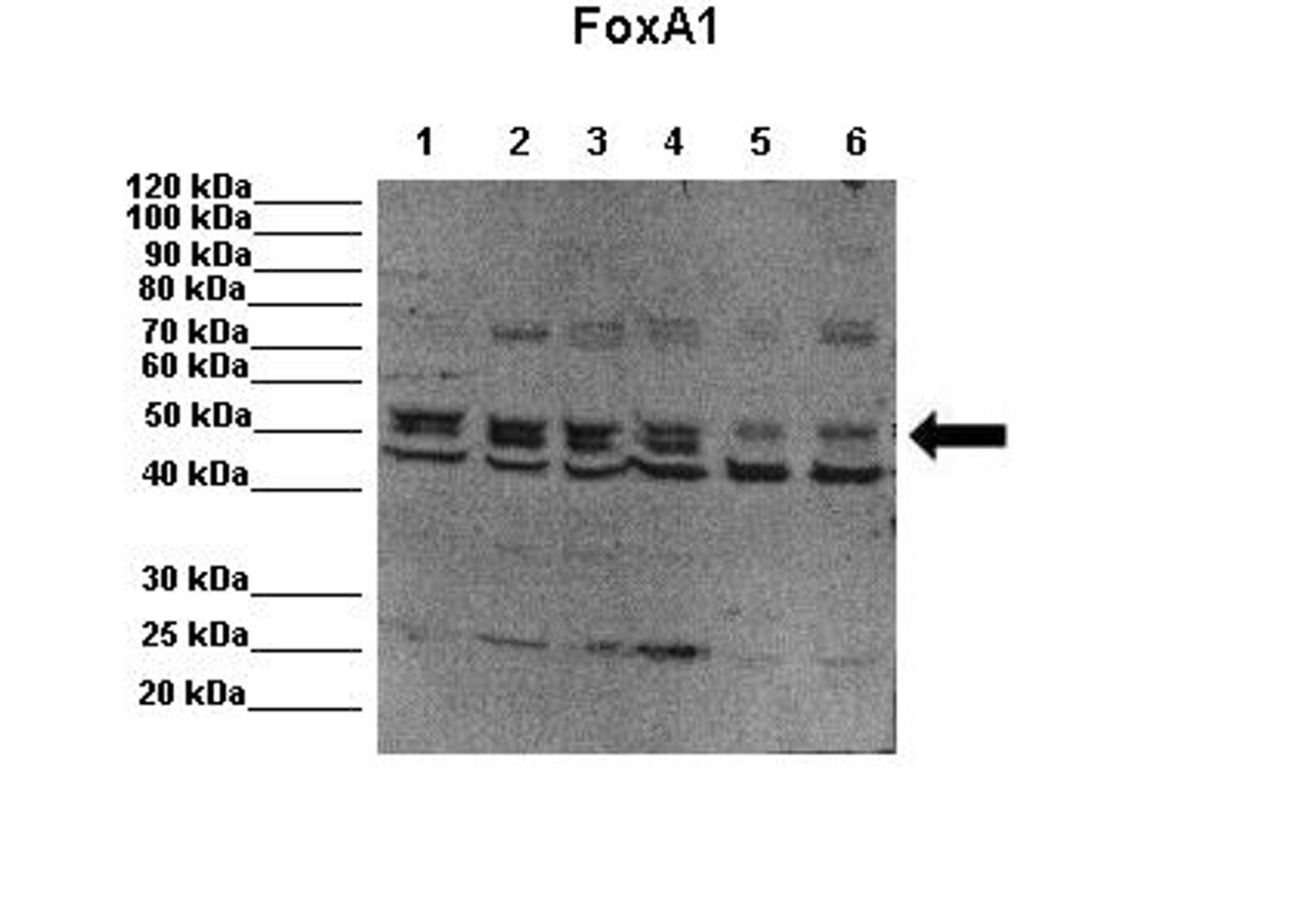 Antibody used in WB on MCF7 at 1:1000 (Lane 1: 20ug MCF7 cell lysates Lane 2: 20ug MCF7 cell lysates Lane 3: 20ug MCF7 cell lysates Lane 4: 20ug MCF7 cell lysates Lane 5: 20ug MCF7 with FoxA1 knockdown Lane 6: 20ug MCF7 with FoxA1 knockdown ) .