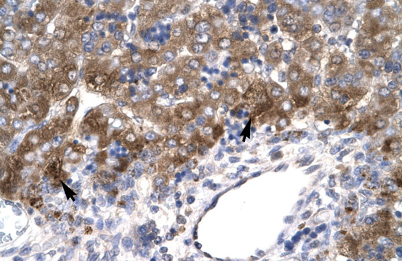 Antibody used in IHC on Human Liver.