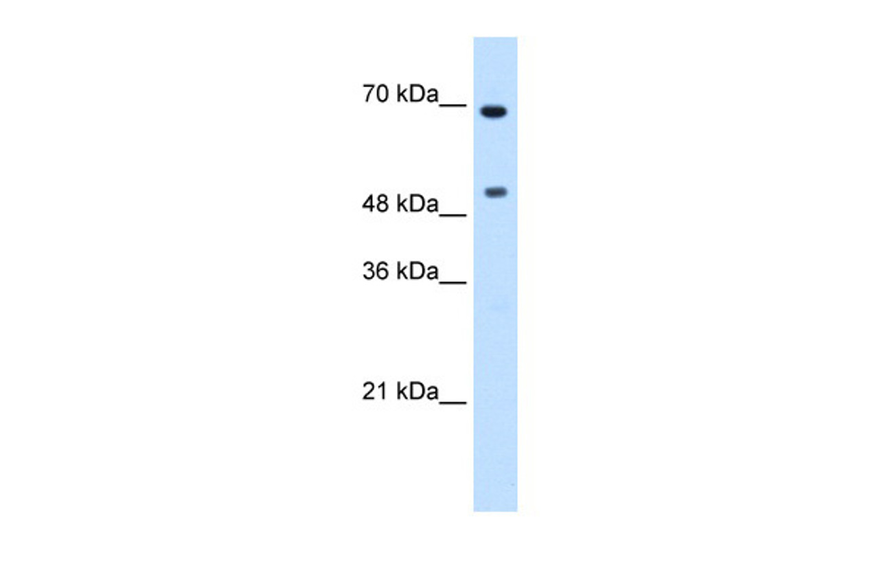 Antibody used in WB on Transfected 293T at 0.0625 ug/ml.