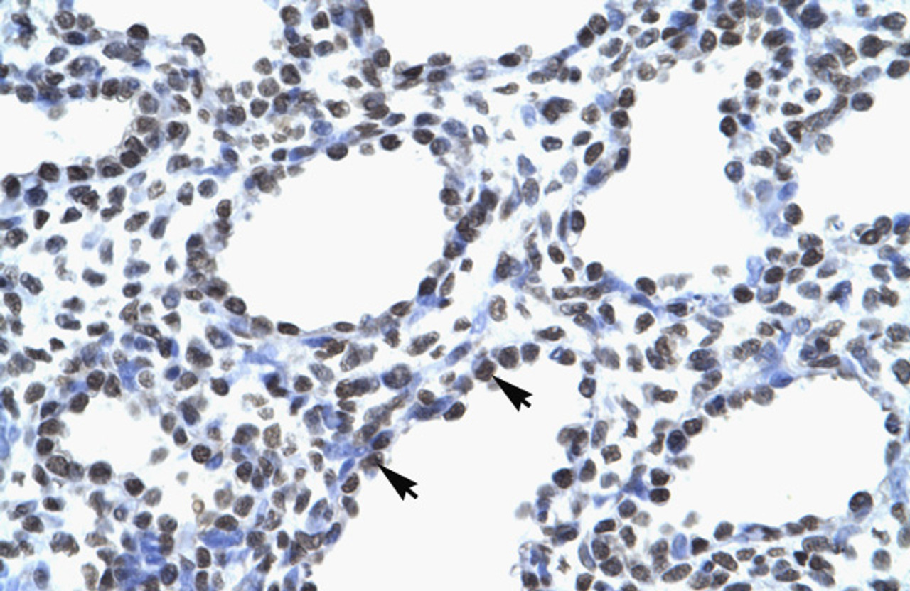 Antibody used in IHC on Human Lung.