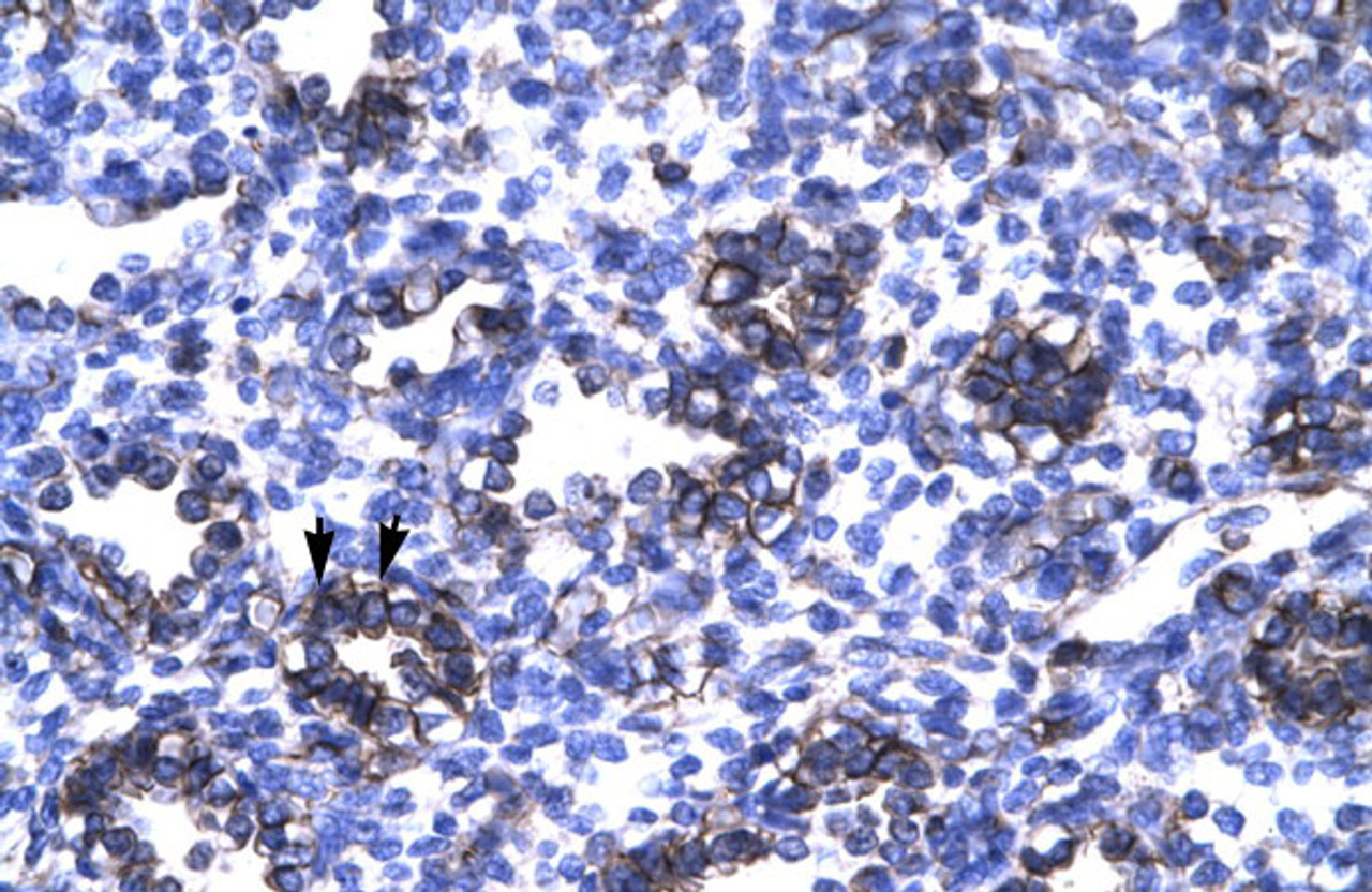 Antibody used in IHC on Human Lung.