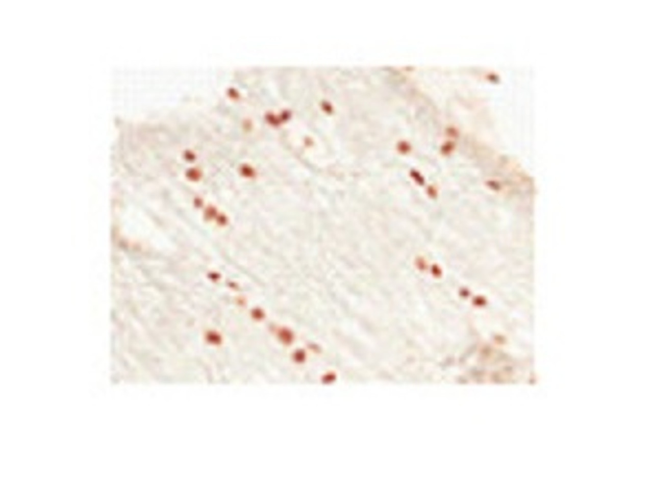 Antibody used in IHC on Human at 1:500.