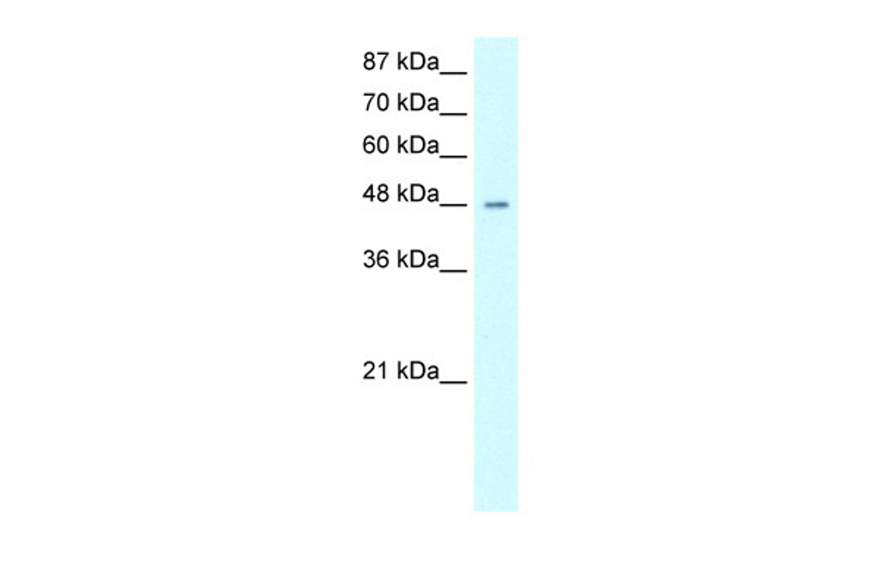 Antibody used in WB on Human 293T at 0.2-1 ug/ml.