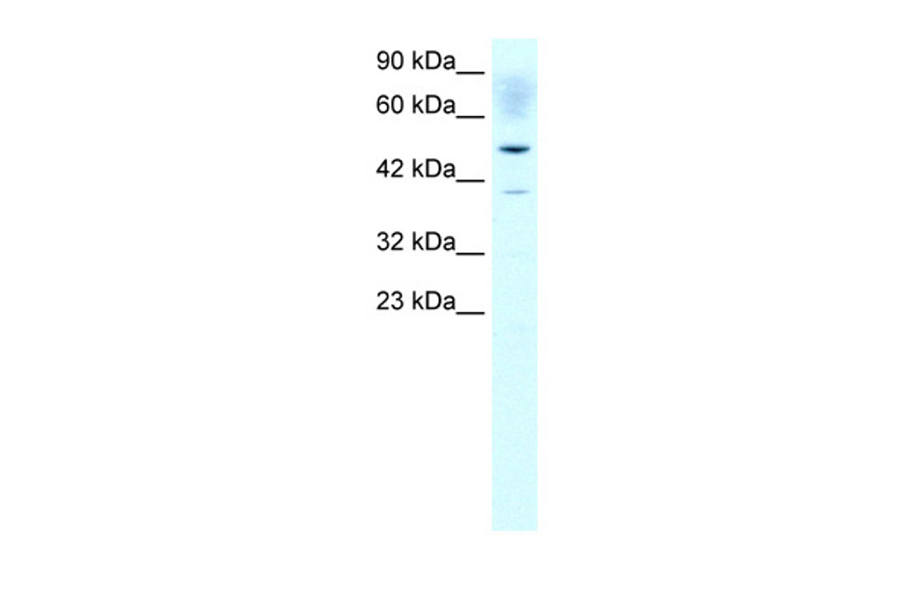 Antibody used in WB on Human K562 at 1 ug/ml.