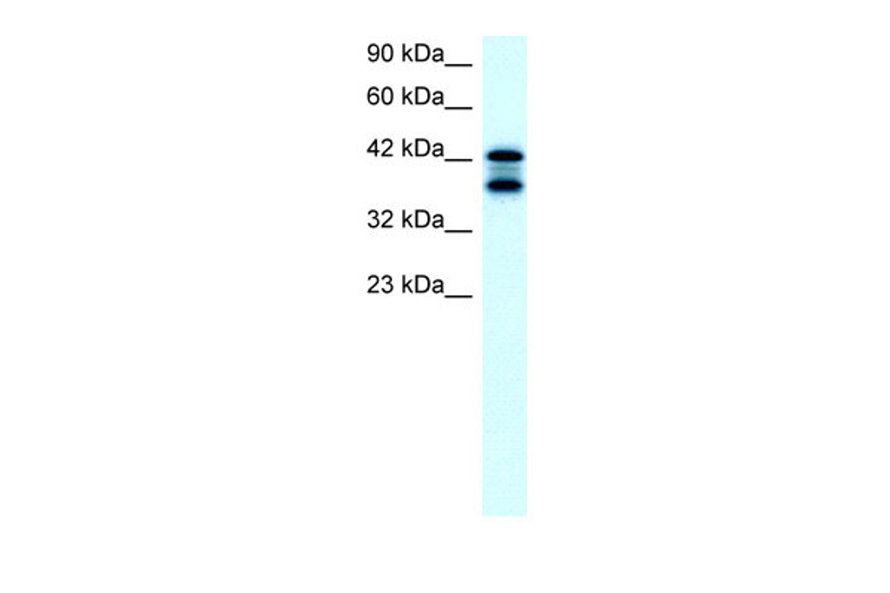 Antibody used in WB on Human K562 at 2.0 ug/ml.