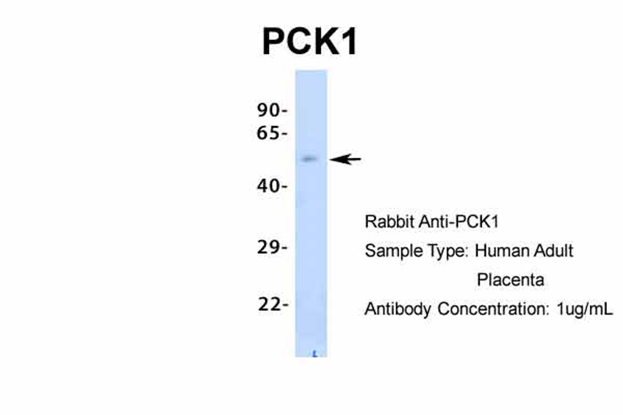Antibody used in WB on Hum. Adult Placenta at 1 ug/ml.