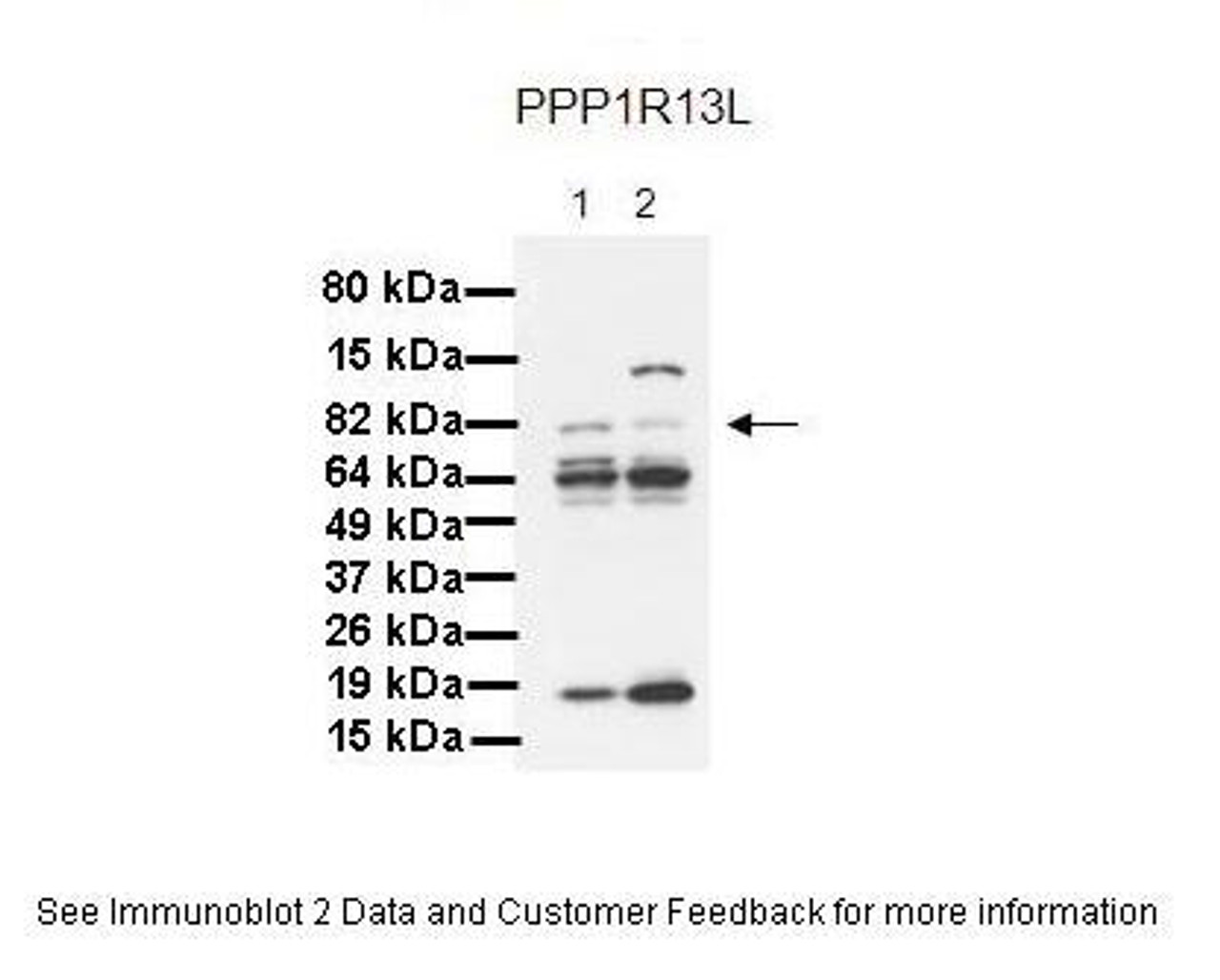 Antibody used in WB on Human cell lines at: 1:1000 (Lane 1. 30 ug MiaPaca-2 cell lysate, Lane 2. 30 ug Panc-1 cell lysate) .