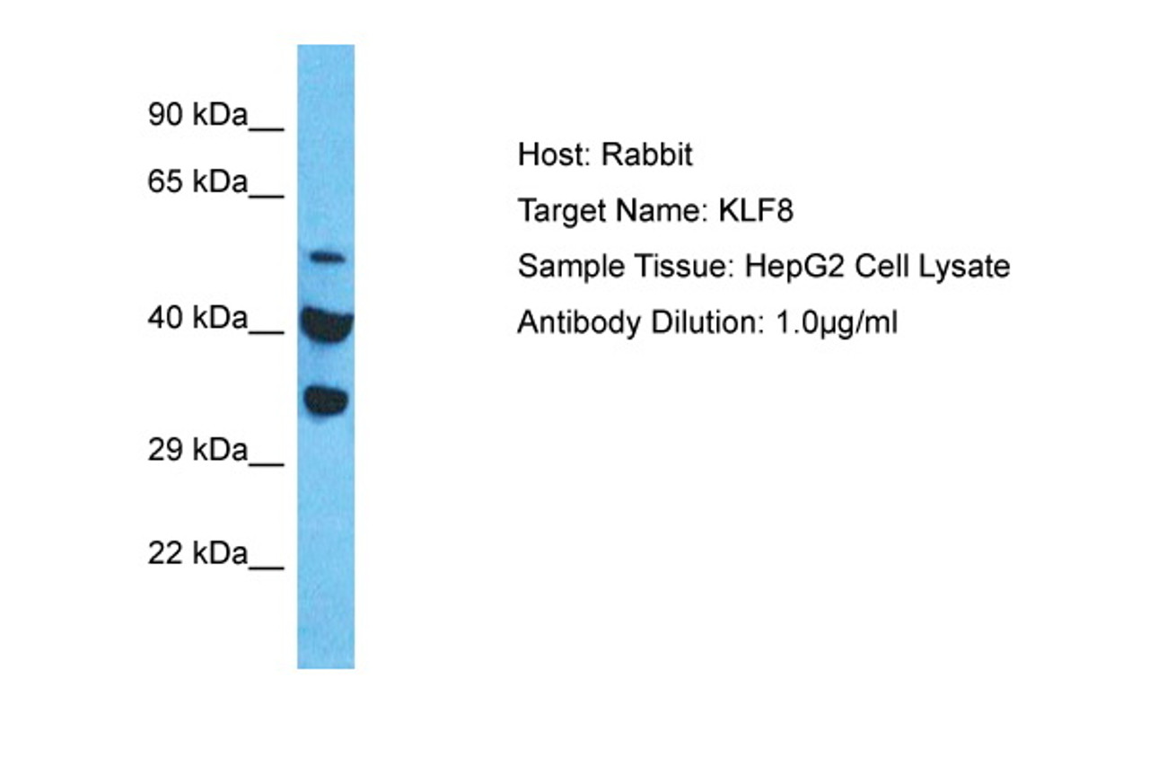 Antibody used in WB on Human HepG2 at 1 ug/ml.