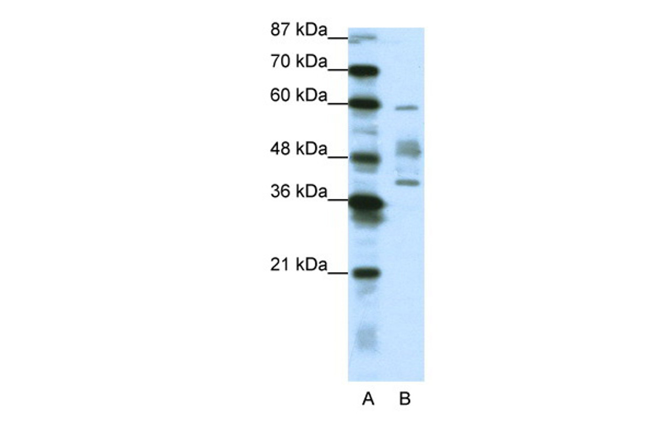 Antibody used in WB on Human NCI-H226 at 1.25 ug/ml.