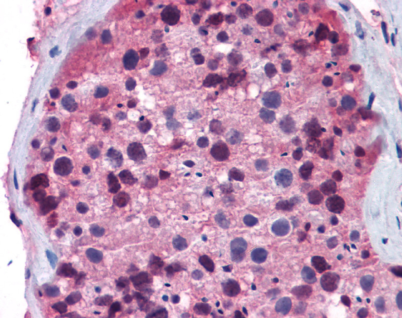 Antibody used in IHC on Human Testis.