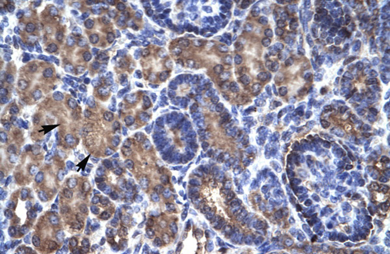 Antibody used in IHC on Human kidney.