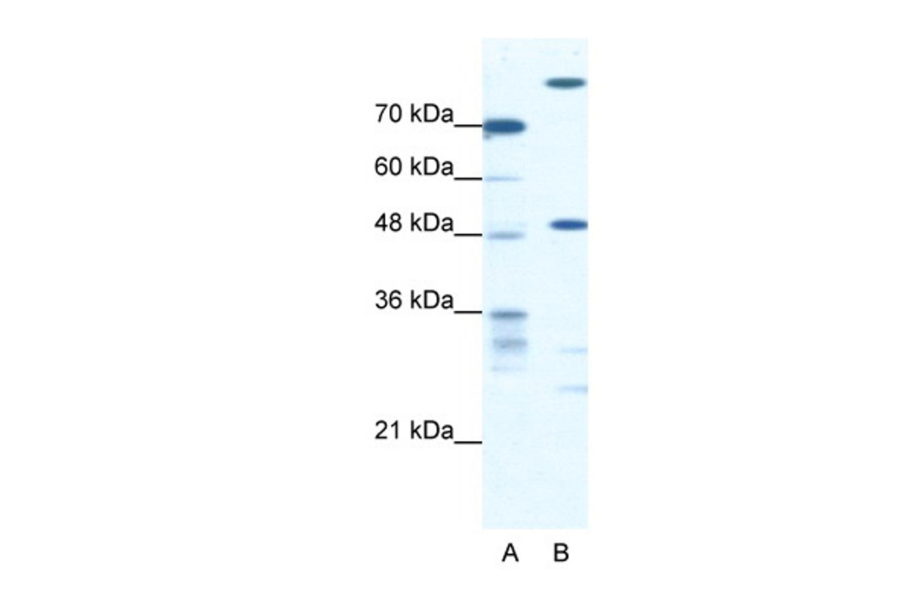 Antibody used in WB on Human Jurkat 0.3125 ug/ml.