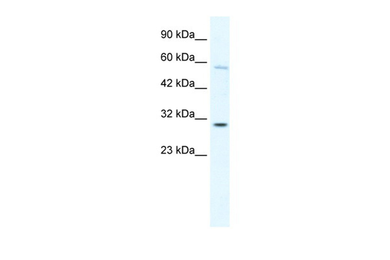 Antibody used in WB on Human K562 cells at 0.2-1 ug/ml.