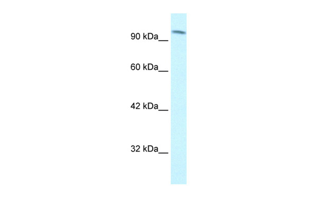 Antibody used in WB on Human Jurkat cells at 1.25 ug/ml.