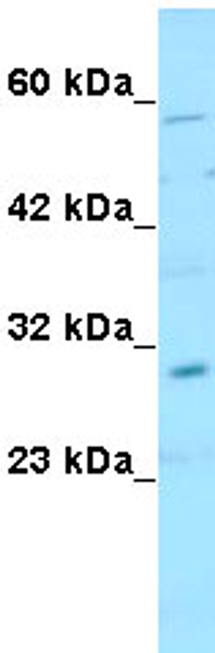 Antibody used in WB on Human 721_B at 1 ug/ml.