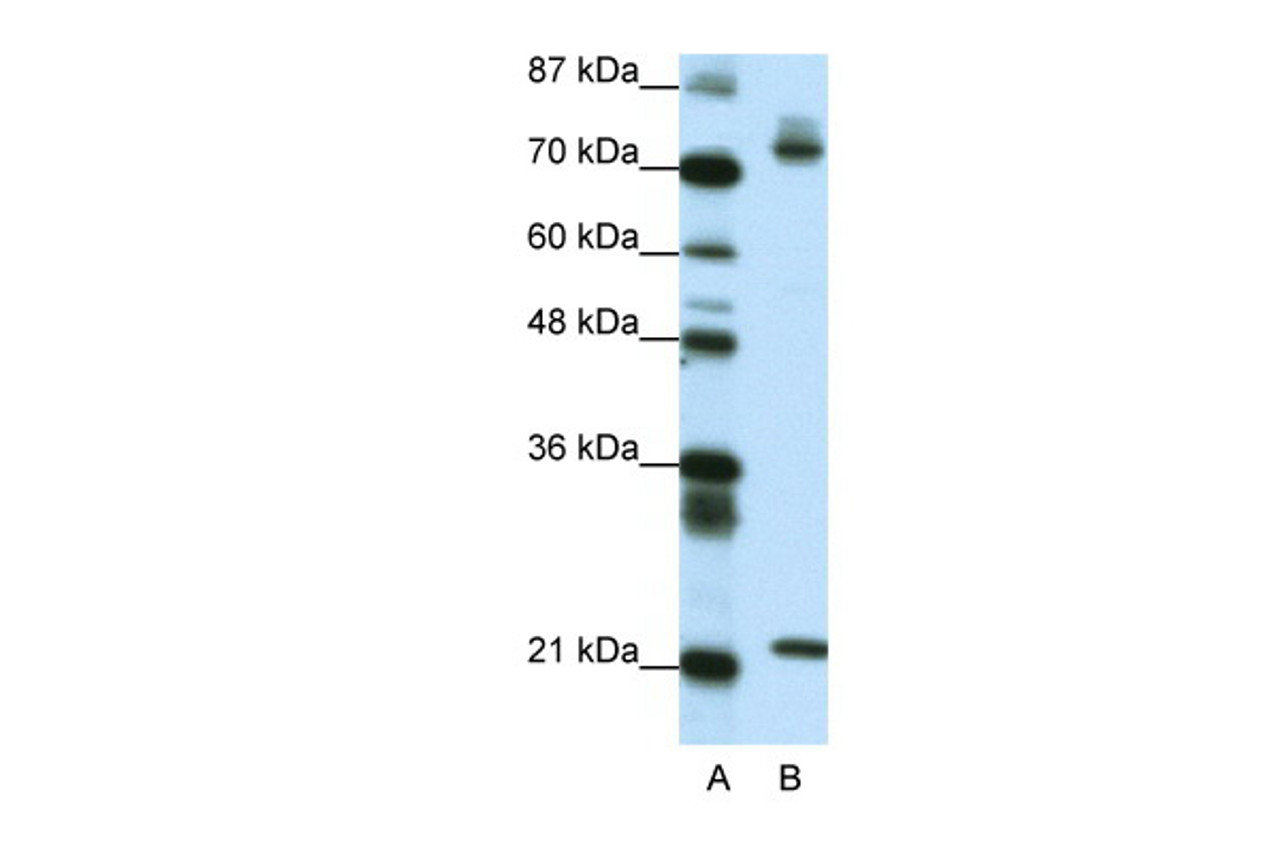 Antibody used in WB on Transfected 293T at 0.2-1 ug/ml.