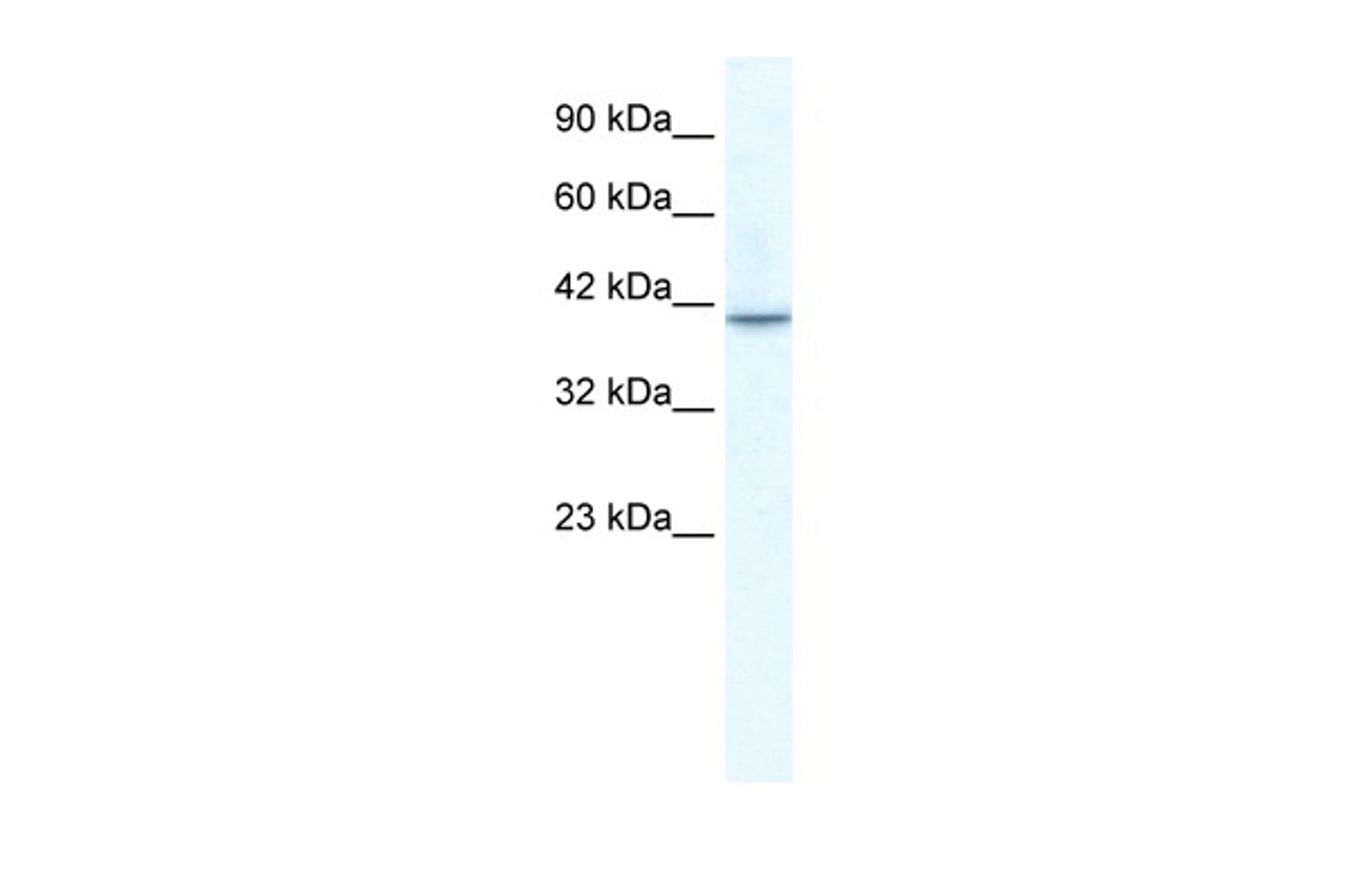 Antibody used in WB on Human Jurkat 5.0 ug/ml.