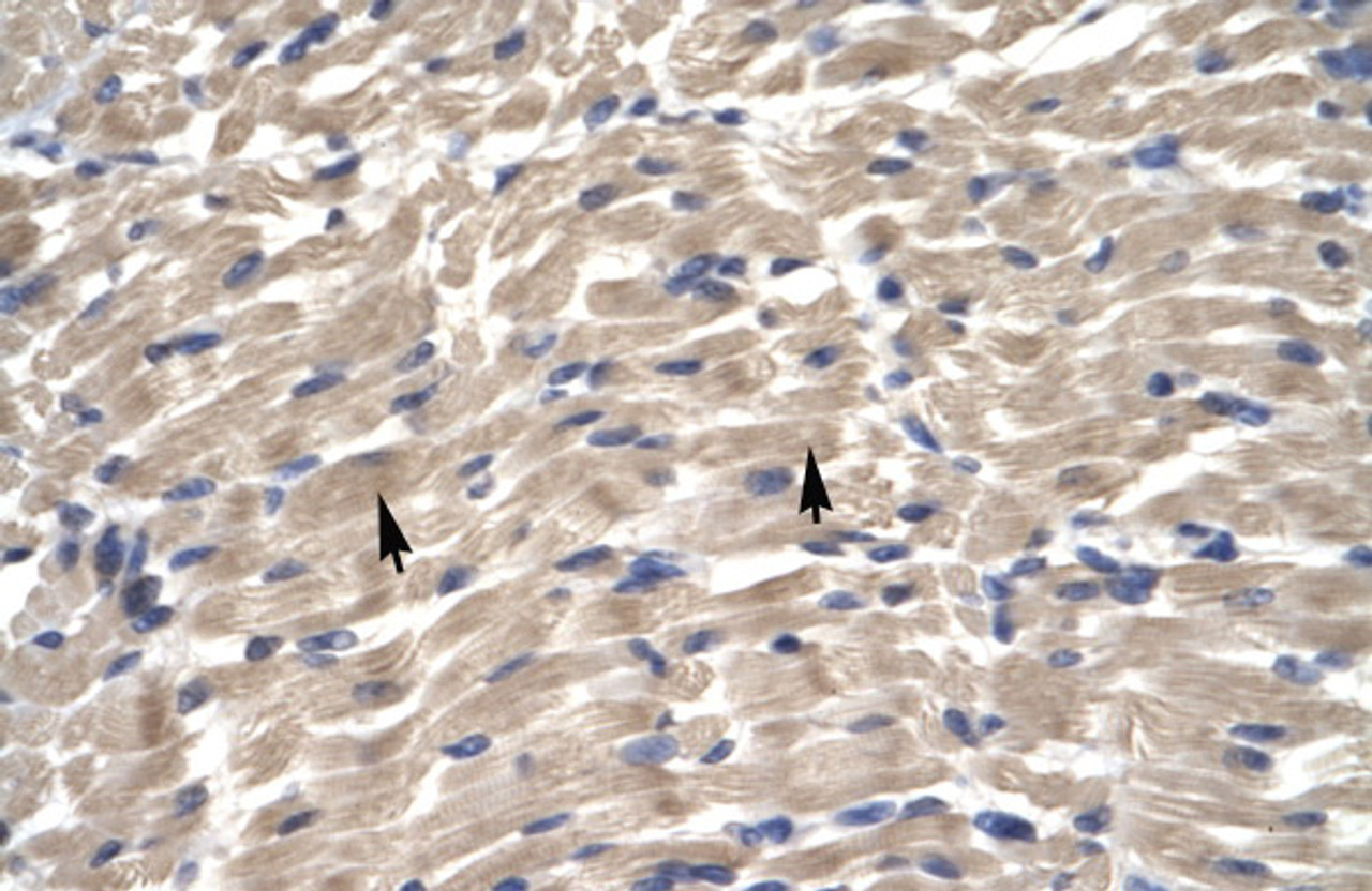 Antibody used in IHC on Human Muscle.