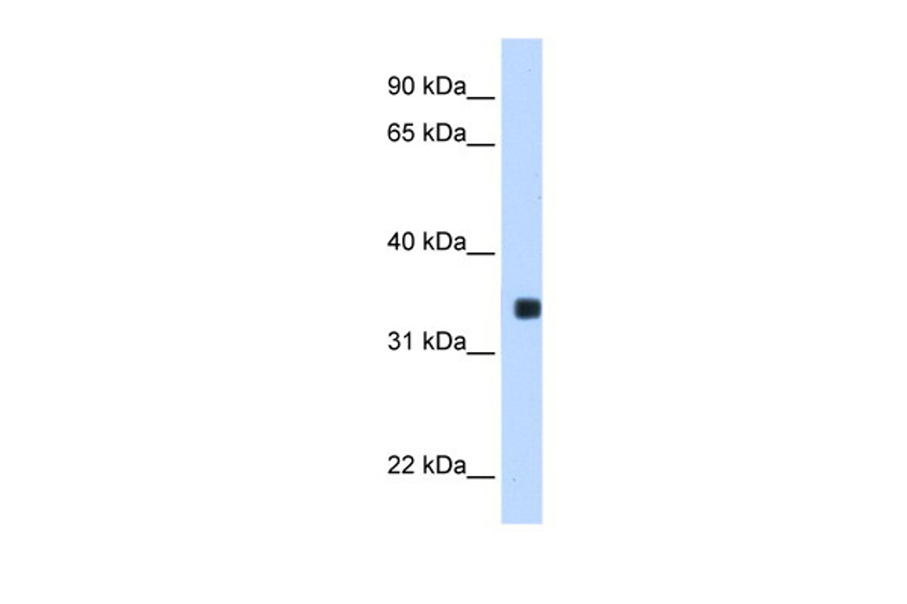 Antibody used in WB on Transfected 293T at 0.2-1 ug/ml.