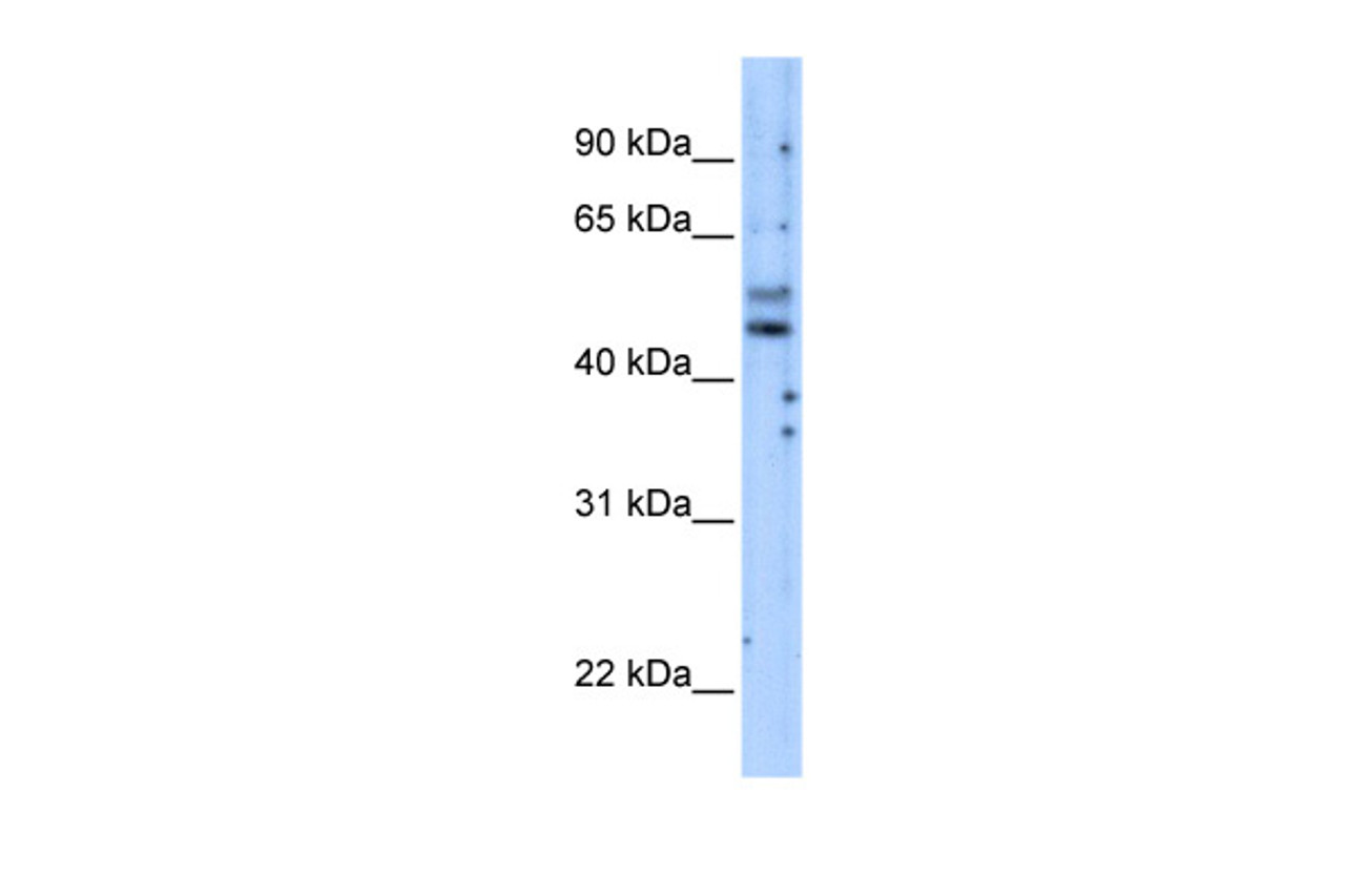 Antibody used in WB on Transfected 293T at 5.0 ug/ml.