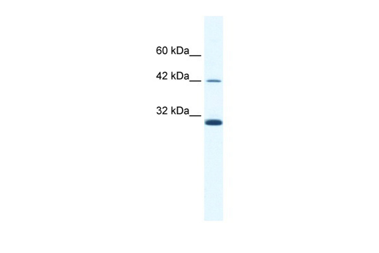 Antibody used in WB on Human Daudi cells at 2.5 ug/ml.