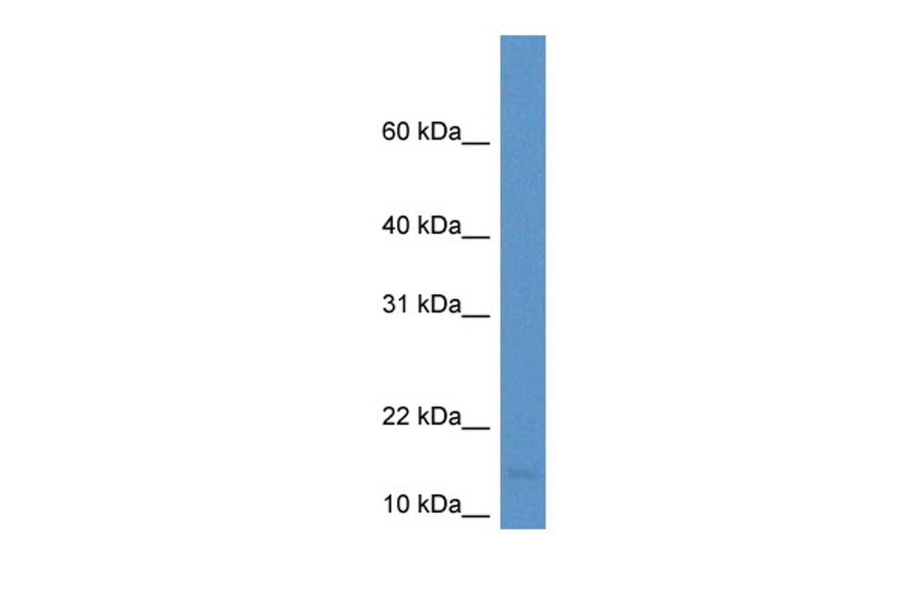 Antibody used in WB on Human Lung at 0.2-1 ug/ml.