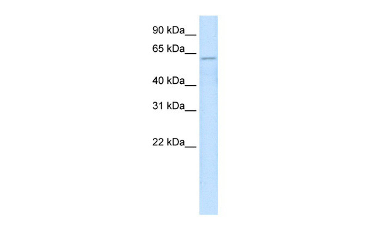 Antibody used in WB on Human Fetal liver at 2.5 ug/ml.