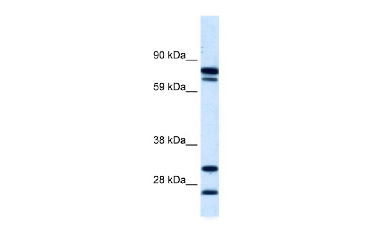 Antibody used in WB on Human kidney at 0.2-1 ug/ml.