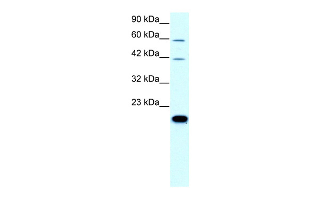 Antibody used in WB on Human HepG2 at 0.2-1 ug/ml.