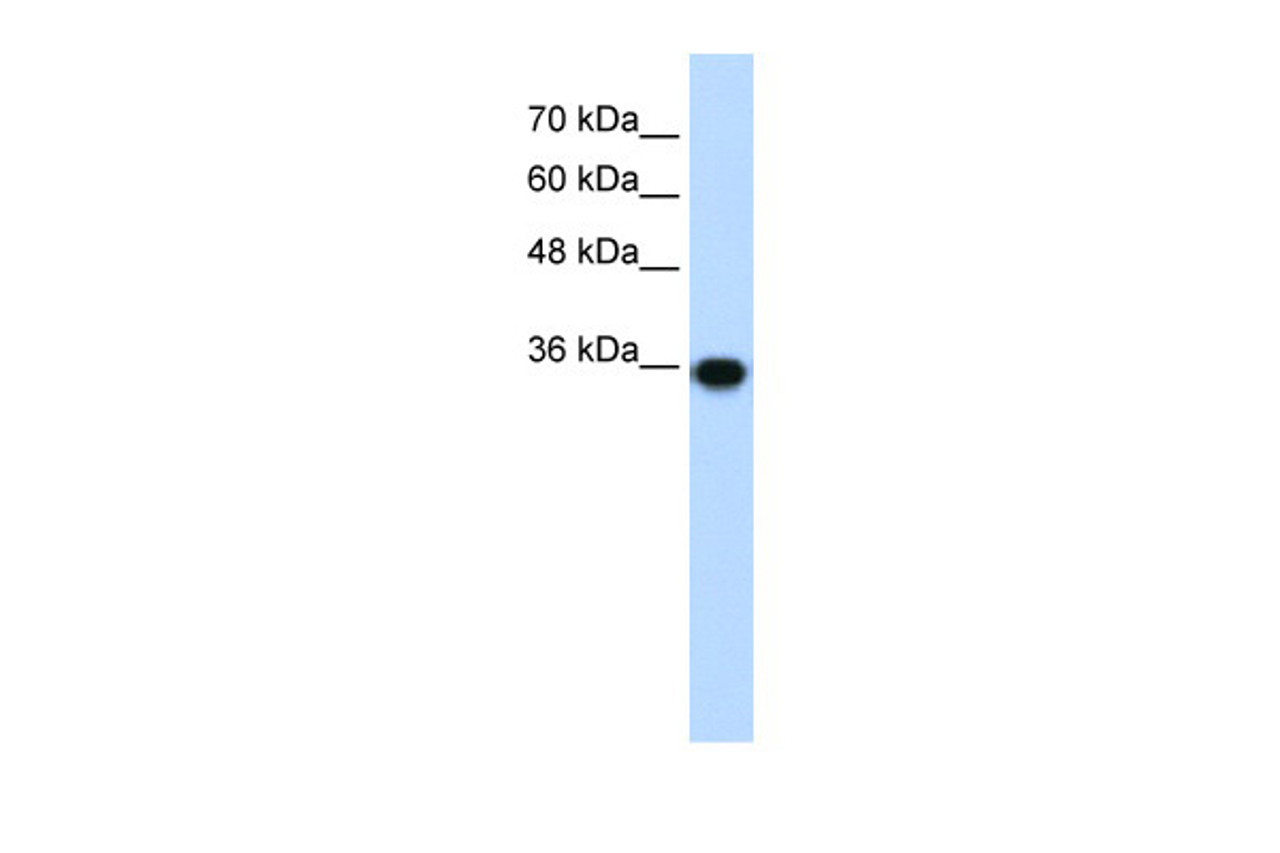 Antibody used in WB on Human HepG2 at 1.25 ug/ml.