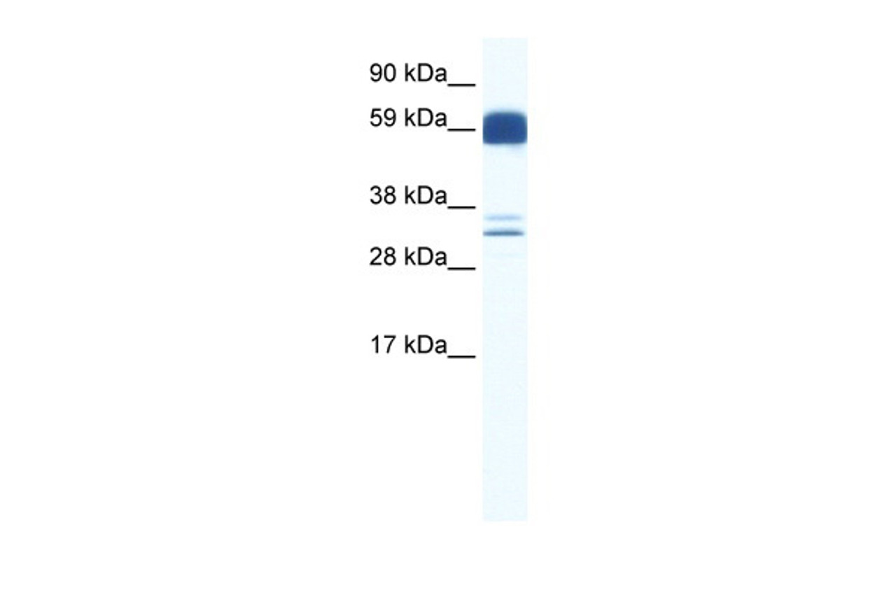 Antibody used in WB on Human Cerebellum at 0.125 ug/ml.