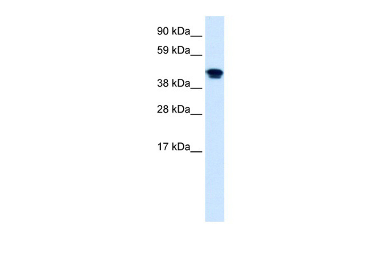 Antibody used in WB on Human Lung at 0.2-1 ug/ml.