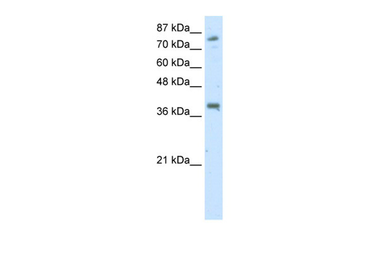 Antibody used in WB on Transfected 293T at 2.5 ug/ml.