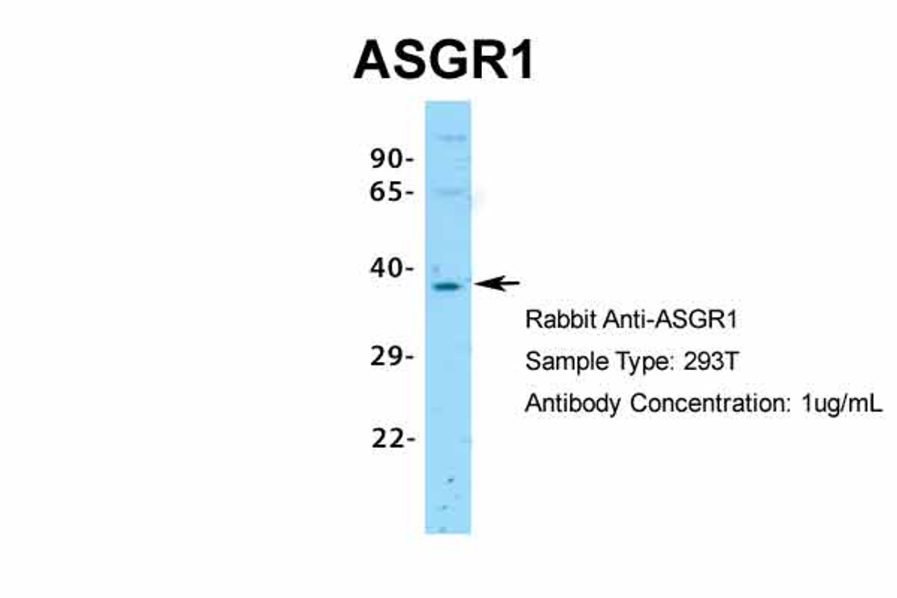 Antibody used in WB on Human 293T at 1 ug/ml.