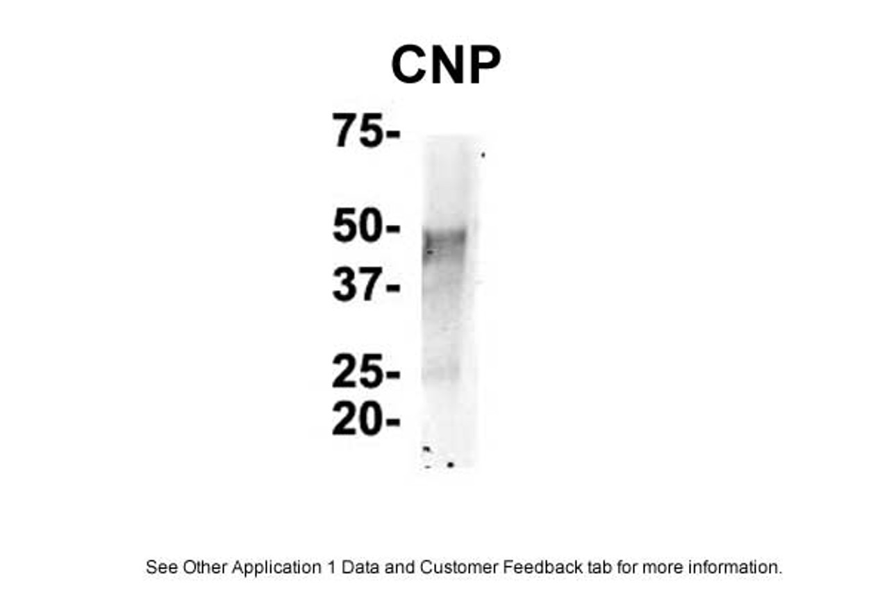 Antibody used in IP on Mouse Brain.