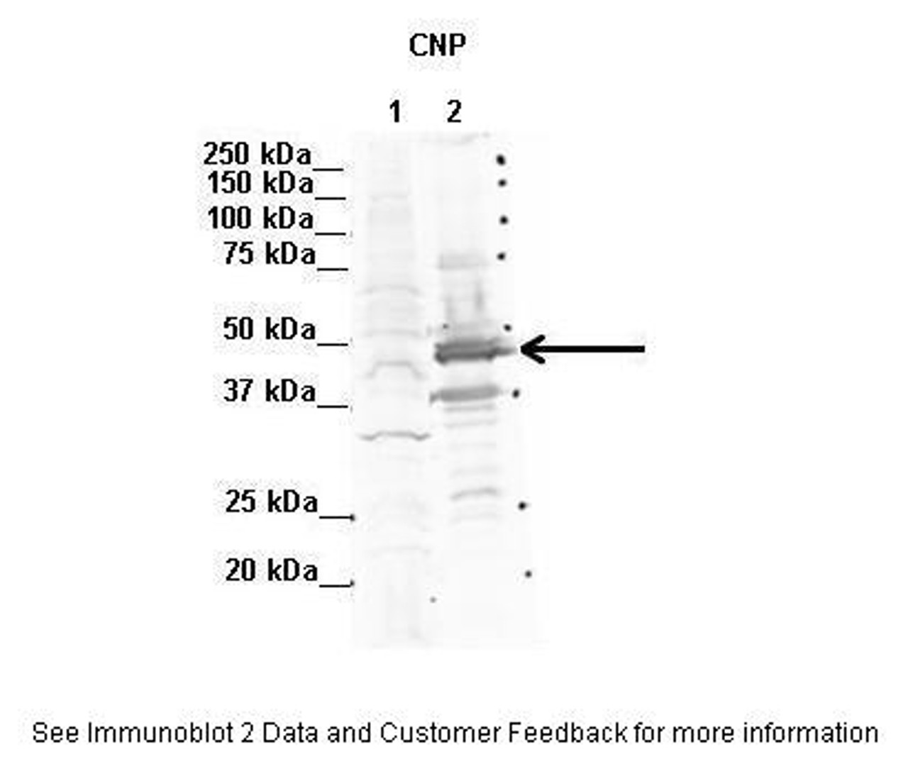 Antibody used in WB on Human NT-2, Rat brain at 2 ug/ml (Lane 1. Human NT-2 cells (60ug) lysate Lane 2. Rat brain extract (80ug) ) .