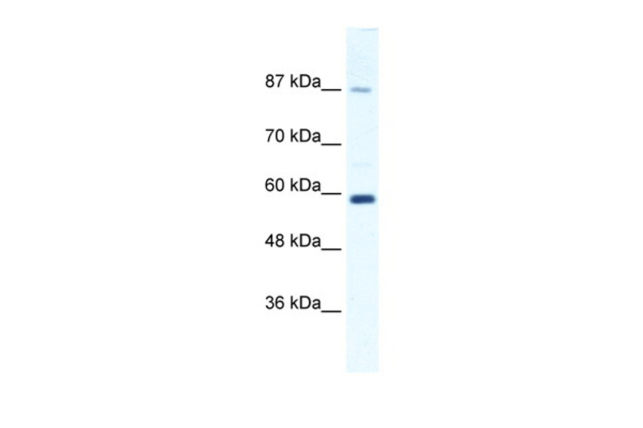 Antibody used in WB on Human Jurkat 1.25 ug/ml.