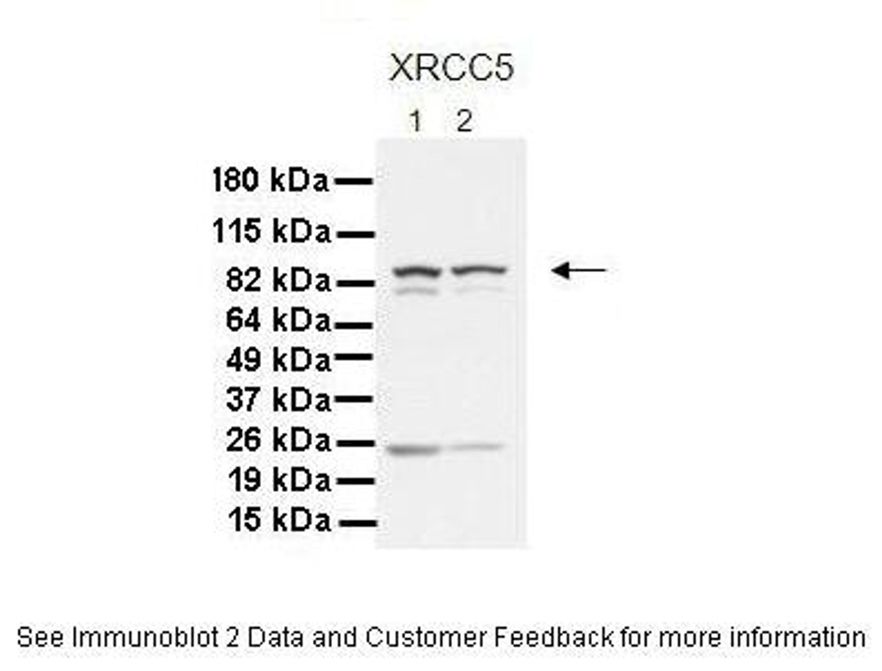 Antibody used in WB on Human cell lines at: 1:1000 (Lane 1. 30 ug MiaPaca-2 cell lysate, Lane 2. 30 ug Panc-1 cell lysate) .