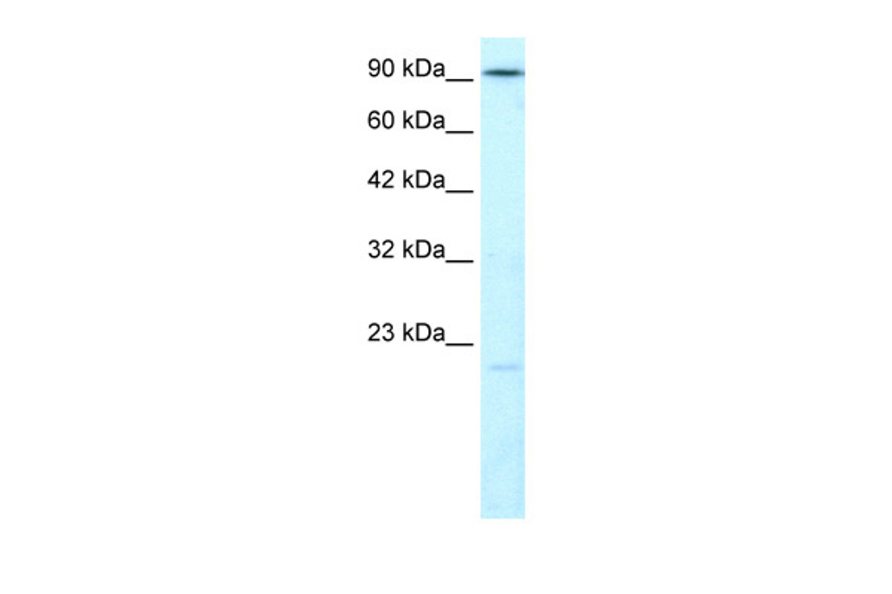 Antibody used in WB on Human HepG2 at 1.25 ug/ml.