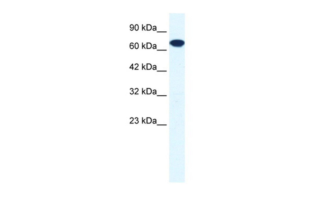 Antibody used in WB on Human HepG2 at 0.2-1 ug/ml.