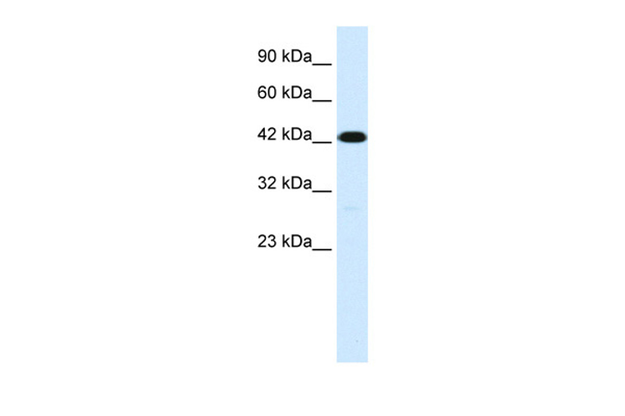 Antibody used in WB on Human Jurkat cells at 1 ug/ml.
