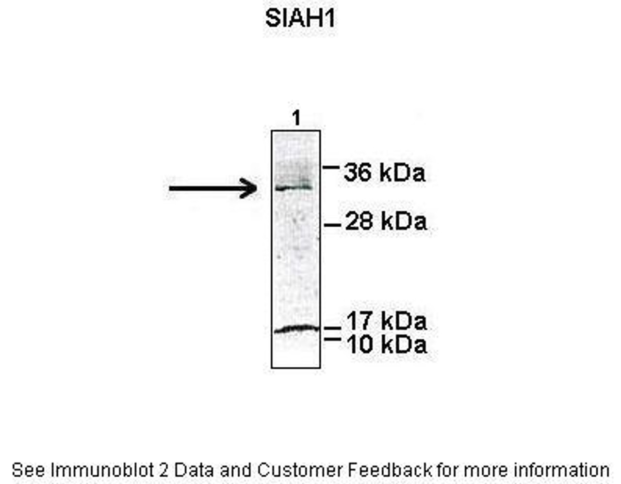 Antibody used in WB on Human HEK293T cells at: 1:1000.