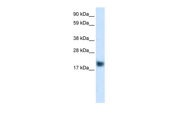 Antibody used in WB on Human Muscle at 1.25 ug/ml.