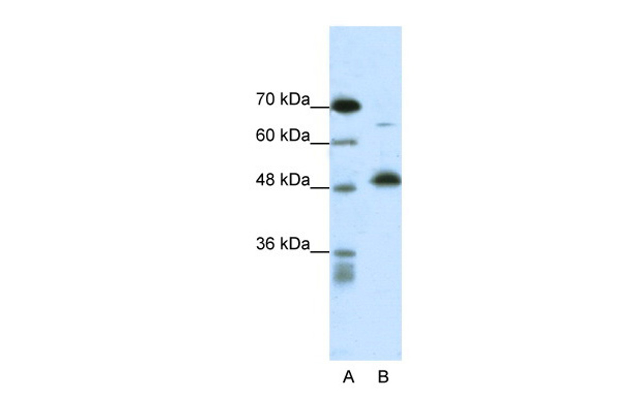 Antibody used in WB on Human Fetal liver at 0.5 ug/ml.