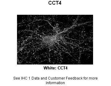 Antibody used in IHC on Rat hippocampal at: 1:200.